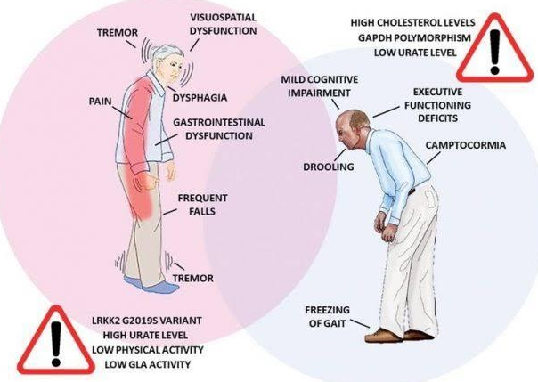 اعراض الباركنسون